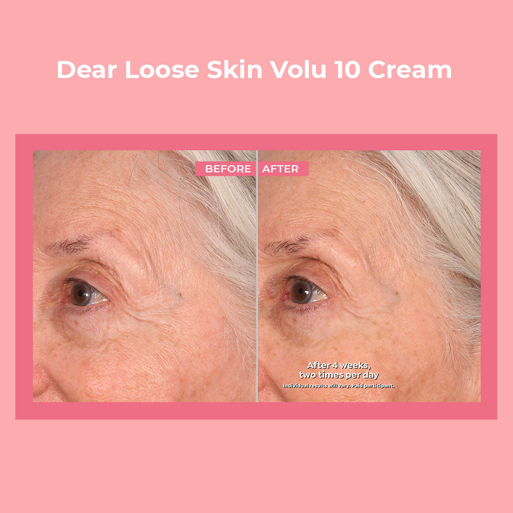 Dr. Tree Dear Loose Skin Volu 10 Cream